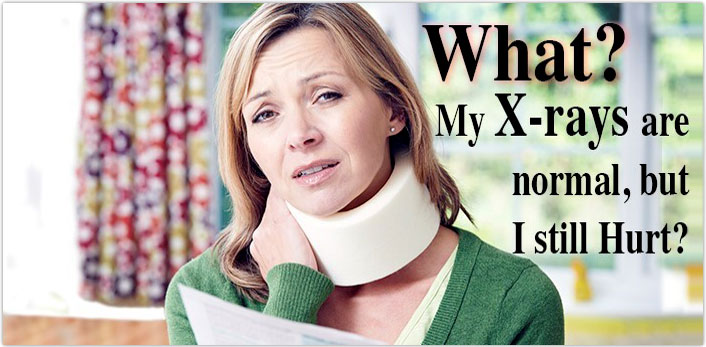 My X-rays are normal, but I still hurt?